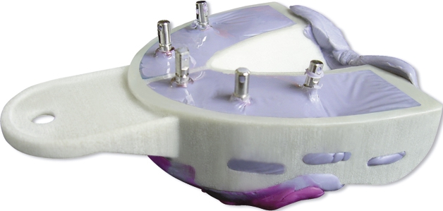 Miratray Implant Les 6 porte-empreintes bas 03-129